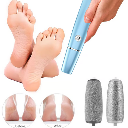 💥Limited time Offer 60%OFF🔥⚡Electric Feet Callus Remover