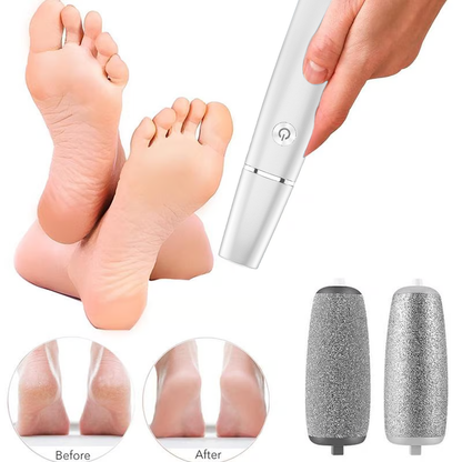 🌸LIMITED SALE : BUY 1 GET 1 FREE!!🌸Electric Feet Callus Remover