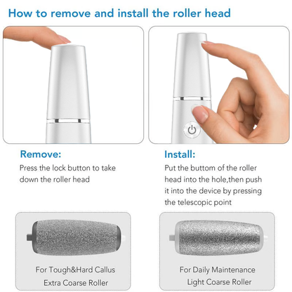🌸LIMITED SALE : BUY 1 GET 1 FREE!!🌸Electric Feet Callus Remover