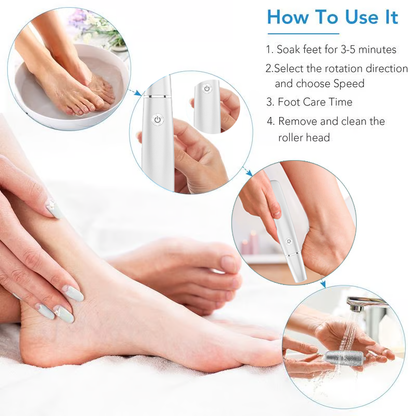 🌸LIMITED SALE : BUY 1 GET 1 FREE!!🌸Electric Feet Callus Remover