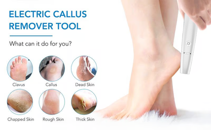 🌸LIMITED SALE : BUY 1 GET 1 FREE!!🌸Electric Feet Callus Remover