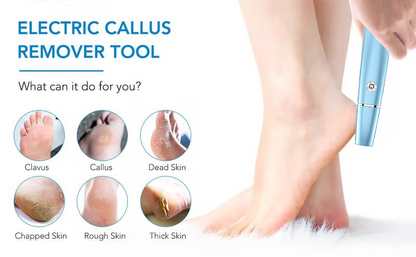 💥Limited time Offer 60%OFF🔥⚡Electric Feet Callus Remover