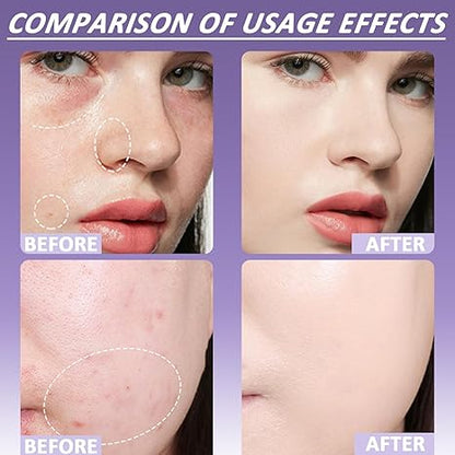 🔥LAST DAY SALE - ONLY £9.99!!⚡50K+ SOLD!💝Soft Matte Cream Concealer