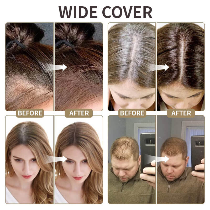 💖Last Day-Buy 1 Get 1 Free💖2025 New Upgraded Magic Root Cover Up✨