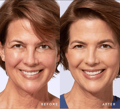 🔥 BUY 1 GET 1 FREE ⏰ Last Day 49% Off-Colour Changing Mature Skin Foundation🎁