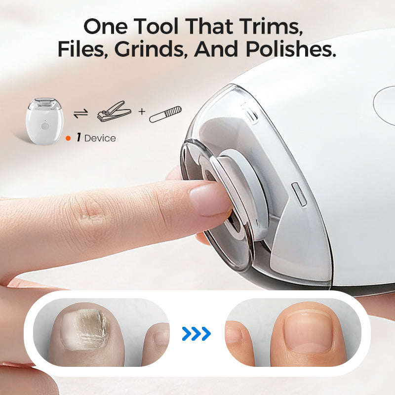 🎅Christmas Special Deals £7.99!!⚡50K+ SOLD!🔥Universal Automatic Fingernail Grinder
