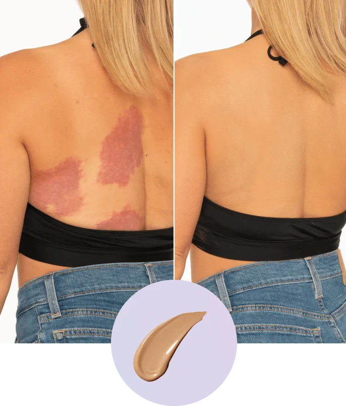 💜Last Day-Buy 1 Get 1 Free!💜✨Body Coverage Perfector – Waterproof, Lightweight & Flawless Body Makeup