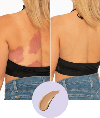 💜Last Day-Buy 1 Get 1 Free!💜✨Body Coverage Perfector – Waterproof, Lightweight & Flawless Body Makeup