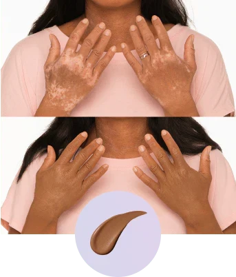 💜Last Day-Buy 1 Get 1 Free!💜✨Body Coverage Perfector – Waterproof, Lightweight & Flawless Body Makeup