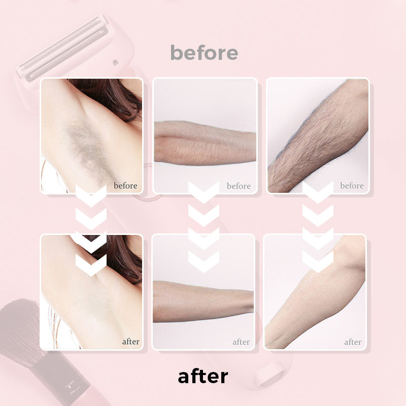 🔥Summer Promotion 49% OFF -💝Multi-functional Shaver for Women