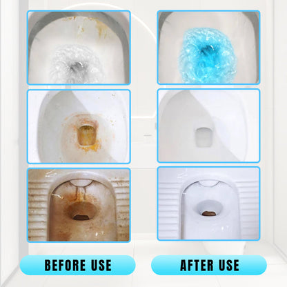 🔥Last Day Promotion 49% OFF - 🏠Effective Concentrated Descaling Toilet Cleaning Stick