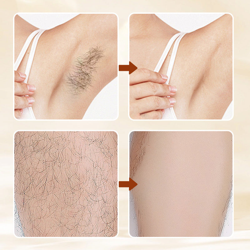 🔥Limited Time Promotion 49% OFF✨Versatile Aromatic  Hair Removal Cream
