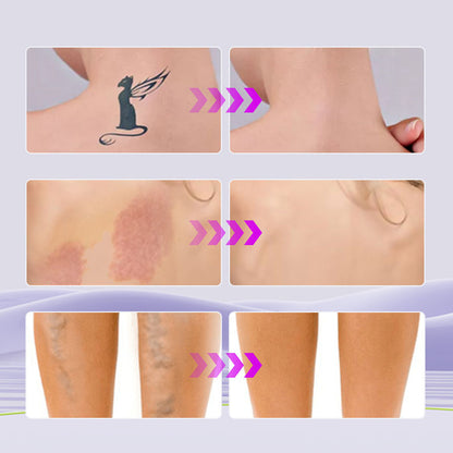 🎁Buy 1 Get 1 Free with FREE BODY BRUSH ✨- DermBlend™ Skin Perfector – The UK’s #1 Dermatologist-Tested Body Concealer